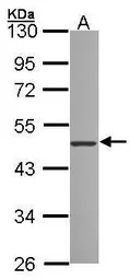 Anti-ZNF277 antibody [N2C3] used in Western Blot (WB). GTX104272