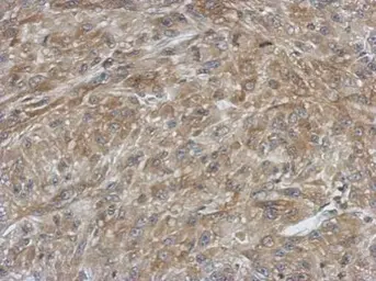 Anti-Ferredoxin Reductase antibody used in IHC (Paraffin sections) (IHC-P). GTX104281