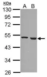 Anti-Ferredoxin Reductase antibody used in Western Blot (WB). GTX104281