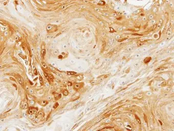 Anti-PDK3 antibody [N1C2] used in IHC (Paraffin sections) (IHC-P). GTX104286