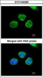 Anti-AKR7A2 antibody used in Immunocytochemistry/ Immunofluorescence (ICC/IF). GTX104299