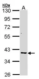 Anti-AKR7A2 antibody used in Western Blot (WB). GTX104299