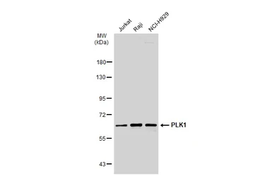 Anti-PLK1 antibody [N2C2], Internal used in Western Blot (WB). GTX104302
