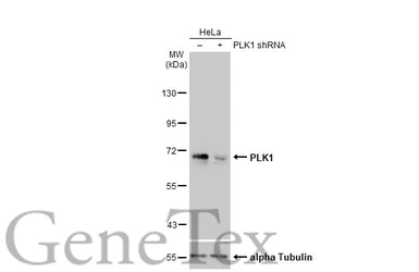 Anti-PLK1 antibody [N2C2], Internal used in Western Blot (WB). GTX104302