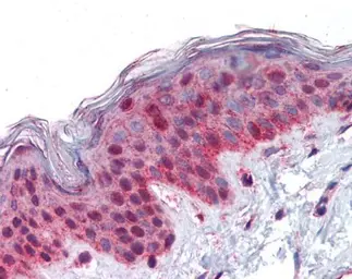 Anti-PLK1 antibody [N2C2], Internal used in IHC (Paraffin sections) (IHC-P). GTX104302
