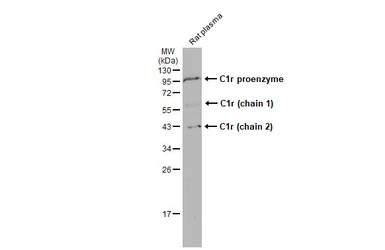 Anti-C1r antibody used in Western Blot (WB). GTX104350