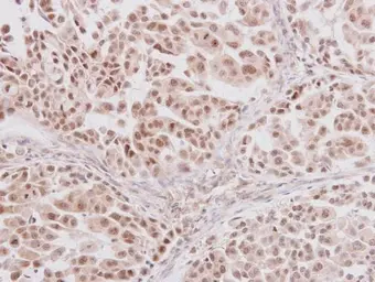 Anti-GLI3 antibody used in IHC (Paraffin sections) (IHC-P). GTX104362