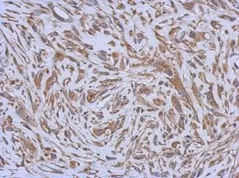Anti-ENTPD3 antibody [N3C3] used in IHC (Paraffin sections) (IHC-P). GTX104376