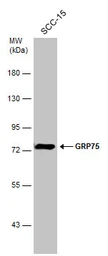 Anti-Grp75 antibody used in Western Blot (WB). GTX104407