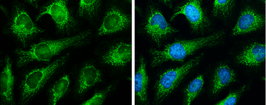 Anti-Grp75 antibody used in Immunocytochemistry/ Immunofluorescence (ICC/IF). GTX104407