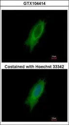 Anti-HLA-DPA1 antibody used in Immunocytochemistry/ Immunofluorescence (ICC/IF). GTX104414