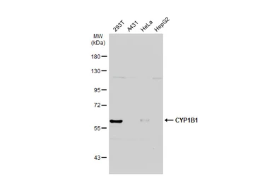 Anti-CYP1B1 antibody used in Western Blot (WB). GTX104424