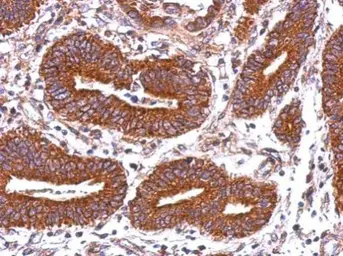 Anti-HLA-DQB2 antibody used in IHC (Paraffin sections) (IHC-P). GTX104461