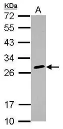 Anti-HLA-DQB2 antibody used in Western Blot (WB). GTX104461