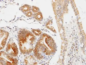 Anti-GLOD4 antibody [N1C3] used in IHC (Paraffin sections) (IHC-P). GTX104484
