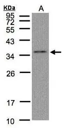 Anti-GLOD4 antibody [N1C3] used in Western Blot (WB). GTX104484