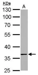 Anti-TMEM59 antibody used in Western Blot (WB). GTX104486