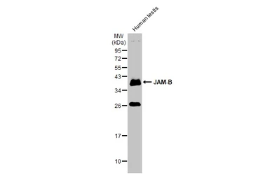 Anti-JAM-B antibody used in Western Blot (WB). GTX104507