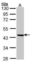 Anti-M/NEI antibody [N1C2] used in Western Blot (WB). GTX104522