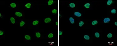 Anti-LDB1 antibody [N2C3] used in Immunocytochemistry/ Immunofluorescence (ICC/IF). GTX104531