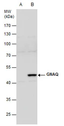Anti-GNAQ antibody used in Western Blot (WB). GTX104544
