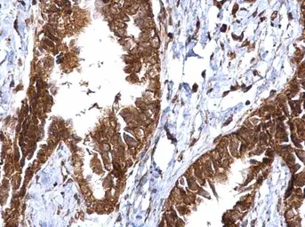 Anti-MMP2 antibody used in IHC (Paraffin sections) (IHC-P). GTX104577