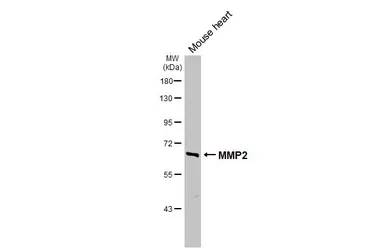 Anti-MMP2 antibody used in Western Blot (WB). GTX104577