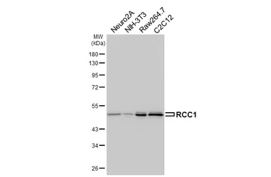 Anti-RCC1 antibody used in Western Blot (WB). GTX104590