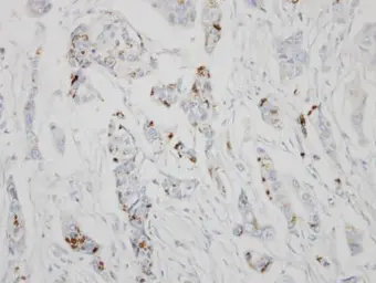 Anti-GALNT6 antibody [N1C2] used in IHC (Paraffin sections) (IHC-P). GTX104602
