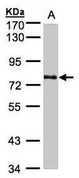 Anti-GALNT6 antibody [N1C2] used in Western Blot (WB). GTX104602