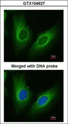 Anti-AKR1C3 antibody [C2C3], C-term used in Immunocytochemistry/ Immunofluorescence (ICC/IF). GTX104627