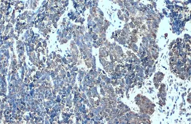 Anti-MMP7 antibody [C2C3], C-term used in IHC (Paraffin sections) (IHC-P). GTX104658