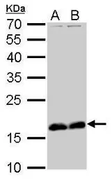 Anti-Stathmin 1 antibody used in Western Blot (WB). GTX104707
