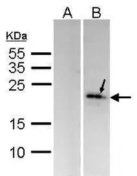 Anti-DUSP14 antibody [C2C3], C-term used in Western Blot (WB). GTX104711
