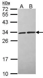 Anti-CacyBP antibody [C2C3], C-term used in Western Blot (WB). GTX104716
