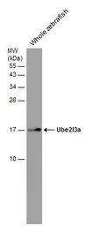 Anti-UBE2L3 antibody used in Western Blot (WB). GTX104717