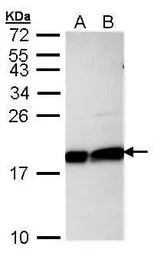 Anti-UBE2L3 antibody used in Western Blot (WB). GTX104717