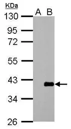 Anti-ARPC1A antibody [N1], N-term used in Western Blot (WB). GTX104743