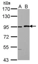 Anti-MAML1 antibody [N1], N-term used in Western Blot (WB). GTX104748