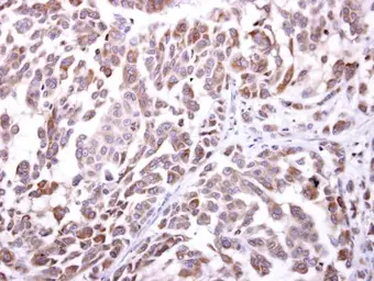 Anti-NKG2D antibody [N3C2], Internal used in IHC (Paraffin sections) (IHC-P). GTX104761