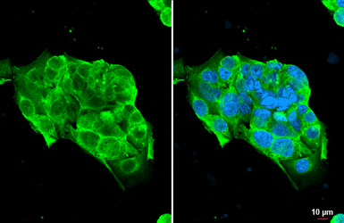 Anti-NKG2D antibody [N3C2], Internal used in Immunocytochemistry/ Immunofluorescence (ICC/IF). GTX104761