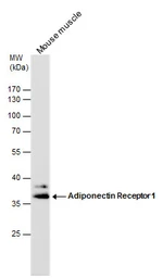 Anti-Adiponectin Receptor 1 antibody [C2C3], C-term used in Western Blot (WB). GTX104770