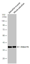 Anti-Adiponectin Receptor 1 antibody [C2C3], C-term used in Western Blot (WB). GTX104770