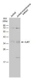 Anti-LAT antibody used in Western Blot (WB). GTX104771
