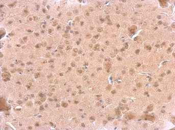 Anti-ARF3 antibody used in IHC (Paraffin sections) (IHC-P). GTX104782