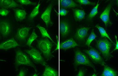 Anti-ARF5 antibody used in Immunocytochemistry/ Immunofluorescence (ICC/IF). GTX104783