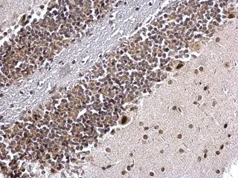 Anti-COUP TF1 antibody [N1], N-term used in IHC (Paraffin sections) (IHC-P). GTX104801