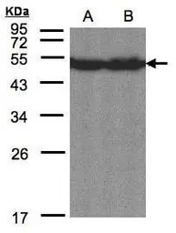 Anti-CREB3L1 antibody [C3], C-term used in Western Blot (WB). GTX104818