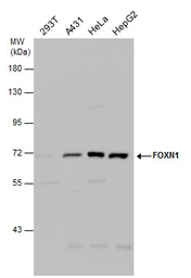 Anti-FOXN1 antibody [C3], C-term used in Western Blot (WB). GTX104849
