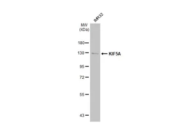 Anti-KIF5A antibody [C3], C-term used in Western Blot (WB). GTX104875